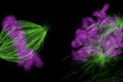 A close-up image of a human umbilical vein endothelial cell with different areas colored green and purple.