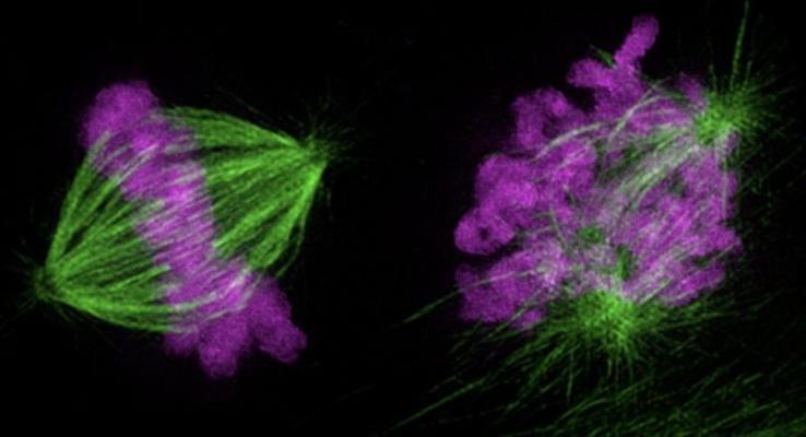 A close-up image of a human umbilical vein endothelial cell with different areas colored green and purple.